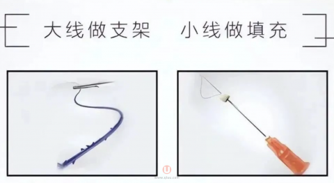 “大v线”和“小v线”是什么意思？