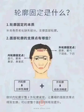 一张图告诉大家什么是轮廓固定？值得收藏！