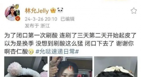 林允刷酸靠不靠谱？最新解读来了