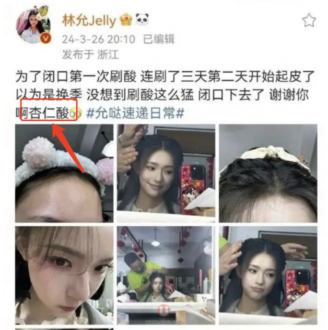 林允微博中感谢的杏仁酸是什么东西？