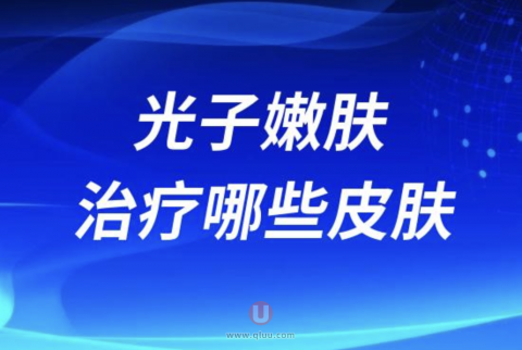 光子嫩肤能解决治疗哪些皮肤问题？