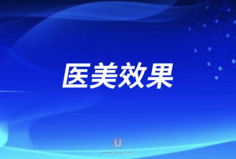 整形医生十大忠告之医美效果反弹