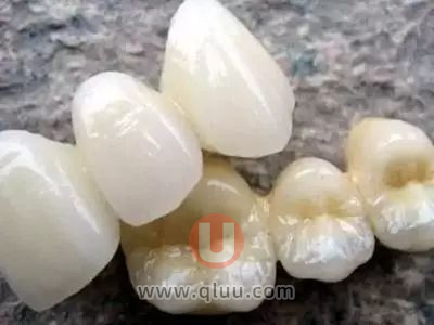 二氧化锆全瓷冠真实图片