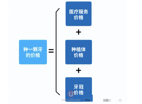集采大揭秘！集采后为什么去做种植牙还是很贵？