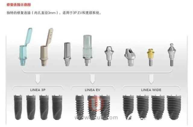 意大利bb种植体与德国种植体选哪个更好？