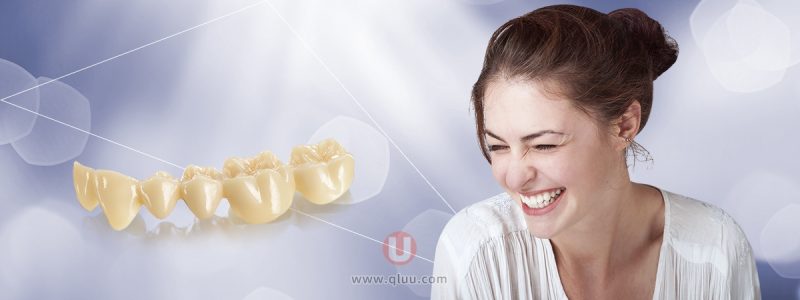 3M拉瓦全瓷牙授权工厂名单查询