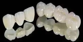 如何从众多的烤瓷牙中选择适合自己的牙冠