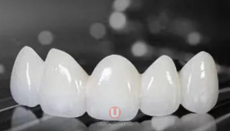 根管治疗后做冠选什么类型的牙冠牙套