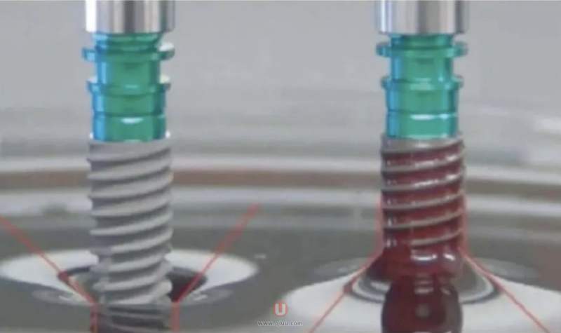 种植牙亲水和非亲水区别！种牙有必要做亲水吗？