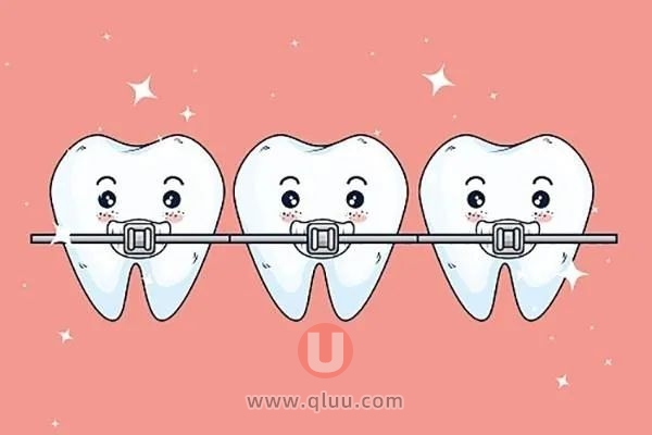 托槽无托槽牙套品牌排行榜全攻略（含国产进口）